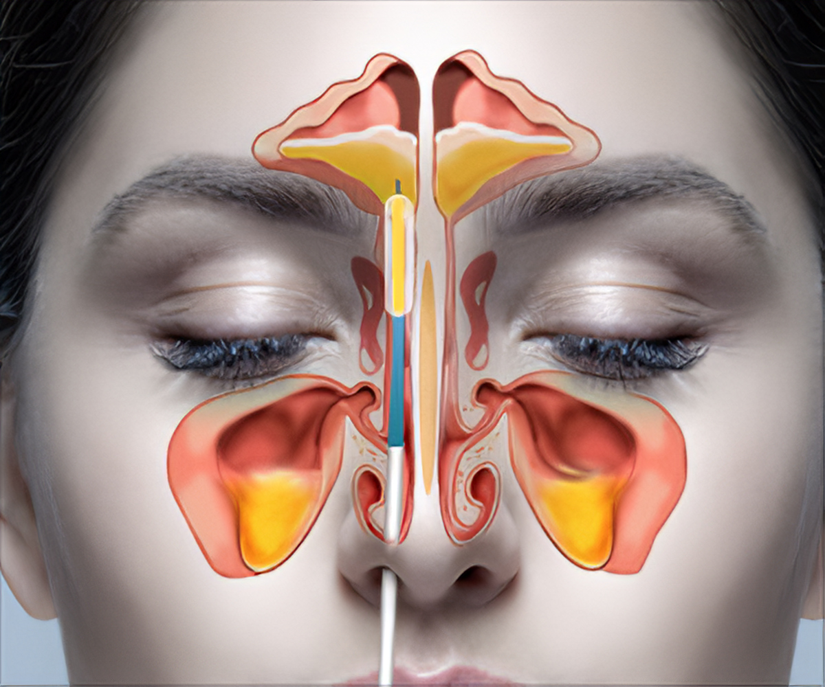 Head and Neck Cancer Treatment